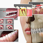 Dental Patient Education Videos