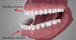 Dentures Treatment in Yorba Linda