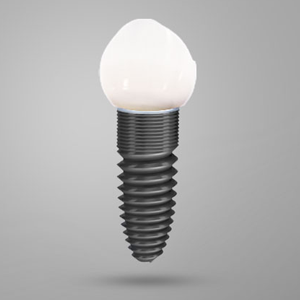 Why Dental Implants the Best Choice? | Yorba Linda, CA