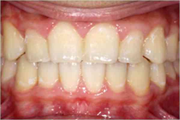 Orthodontics After 