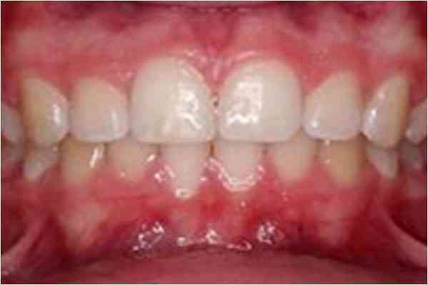 Orthodontics After 