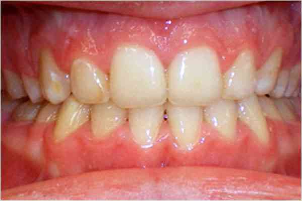 Orthodontics After