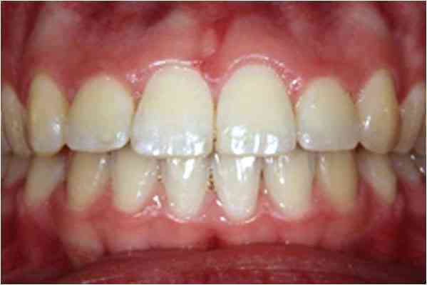 Orthodontics After 